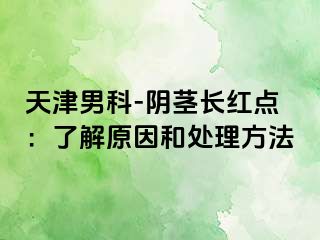 天津男科-阴茎长红点：了解原因和处理方法