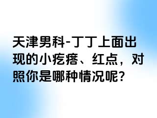 天津男科-丁丁上面出现的小疙瘩、红点，对照你是哪种情况呢？