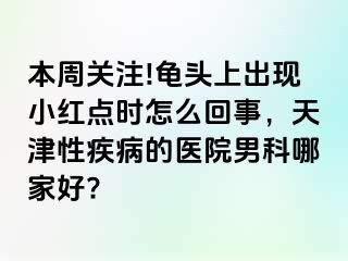 本周关注!龟头上出现小红点时怎么回事，天津性疾病的医院男科哪家好?