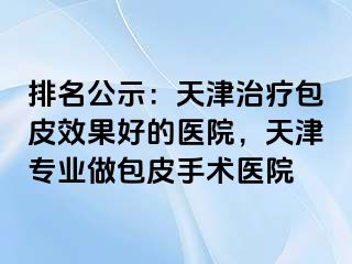 排名公示：天津治疗包皮效果好的医院，天津专业做包皮手术医院