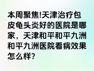 本周聚焦!天津治疗包皮龟头炎好的医院是哪家,天津和平和平九洲和平九洲医院看病效果怎么样?